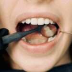 Impact of Oral Cancer on Human Health: An In-Depth Exploration